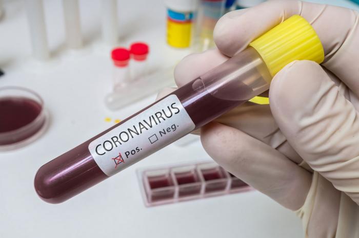 Coronavirus — Its Impact on HIV and the LGBTQ Community