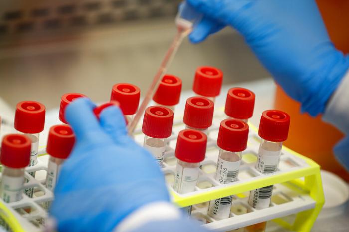A technician prepares COVID-19 coronavirus patient samples for testing at a laboratory in New York's Long Island. 