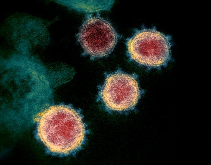 This undated electron microscope image made available by the U.S. National Institutes of Health in February 2020 shows the virus that causes COVID-19