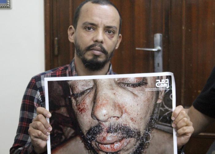 Tunisian prominent LGBTQ activist Badr Baabou holds a photograph of himself after he was beaten, during an interview with The Associated Press in Tunis.