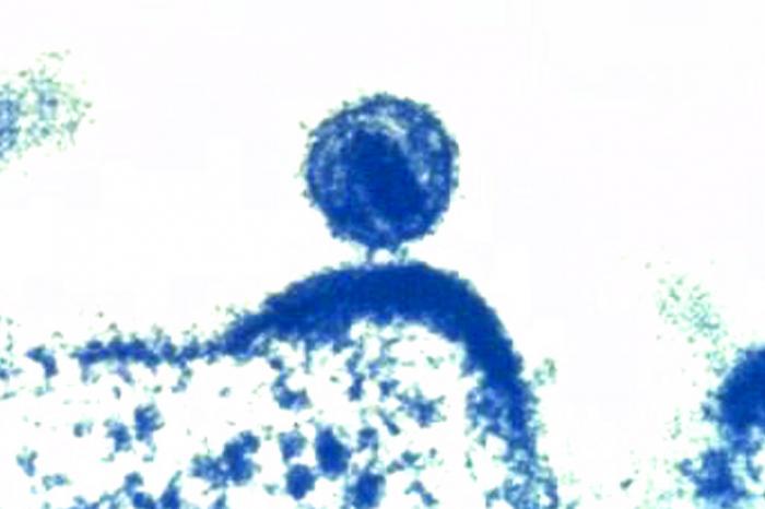 A single human immunodeficiency virus, center, as it buds from a human immune cell, which the virus has infected, and within which the HIV virus has been replicated.