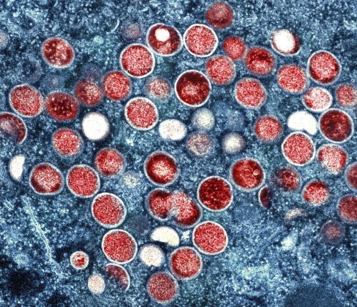 A colorized transmission electron micrograph of monkeypox particles (red) found within an infected cell (blue), cultured in the laboratory that was captured and color-enhanced at the NIAID Integrated Research Facility (IRF) in Fort Detrick, Md.