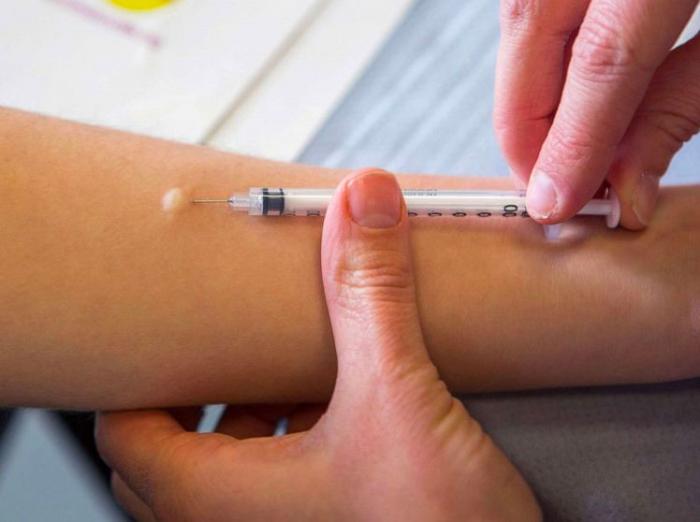 A photo of the mpox vaccine being administered