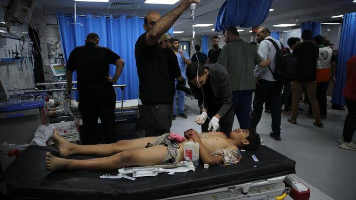 Palestinian wounded in Israeli strikes is treated in Shifa Hospital in Gaza City, Friday, Oct. 13, 2023. (AP Photo/Ali Mahmoud)
