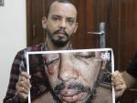Tunisia: LGBTQ Activist's Assault by Police Seen as a Pattern
