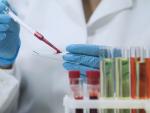 Study Identifies Virulent HIV Variant Unrecognized for Years