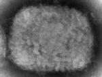 US Case of Monkeypox Reported in Massachusetts Man