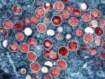 WHO Plans to Rename Monkeypox over Stigmatization Concerns