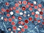 WHO Renames Monkeypox as mpox, Citing Racism Concerns