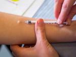 French Mpox Cluster Alarms Health Experts Concerned About Mutation