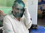 Masked Assailants Attack a Journalist and a Lawyer in Russia's Chechnya Province